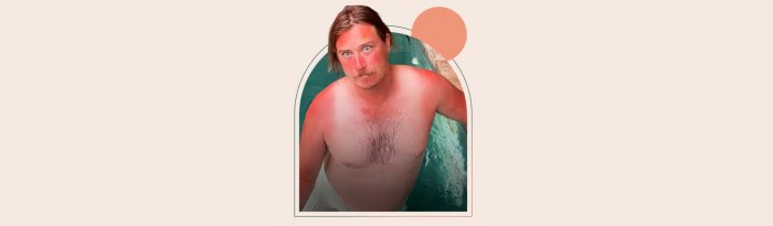 Rohan Arneil: You Wouldn't Have Cut Me Off If I Wasn't So Sunburnt